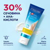 Інтенсивно пом'якшувальний крем-маска для ніг 30%